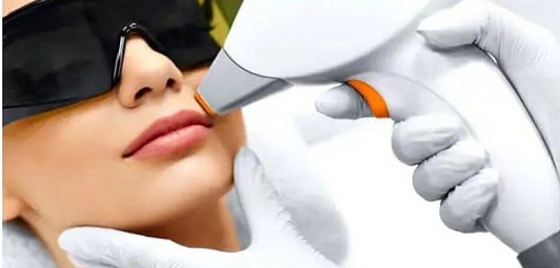 Czas na trwałe rozwiązania — dlaczego depilacja laserowa wygrywa